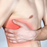 Лечение межреберной невралгии