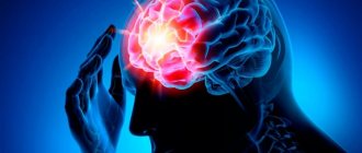 Left-sided ischemic stroke
