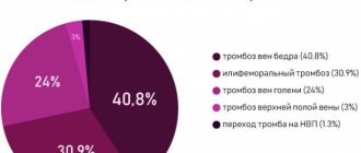 Локализация тромбозов