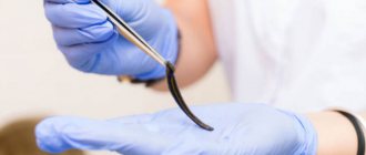 Medical leech