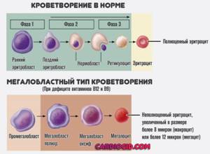 В схеме кроветворения ретикулоциты относятся к какому классу
