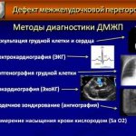Methods for diagnosing VSD