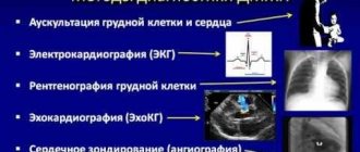 Methods for diagnosing VSD