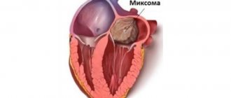 Myxoma