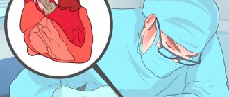 Mitral stenosis: causes and consequences of the disease
