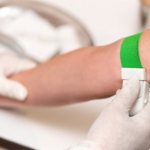 Application of a tourniquet