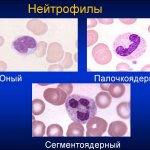 нейтрофилы