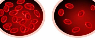 Normal hemoglobin level in men