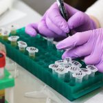 Normal blood cholesterol levels in men: table of values ​​for different ages