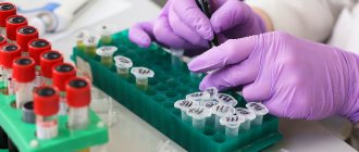 Normal blood cholesterol levels in men: table of values for different ages