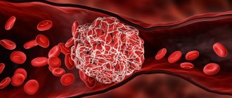Clot formation.jpg
