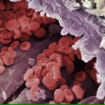formation of fibrin clots