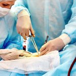 CABG surgery in the clinic