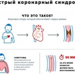 описание острого коронарного синдрома