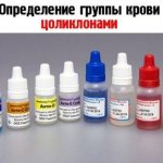 Determination of blood group by zoliclones