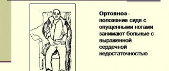 Ортопноэ