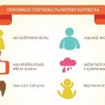 Основные причины варикоза