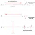 Basic principles of electrocardiography