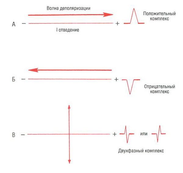 Р положительный. Двухфазный зубец p. Двухфазный зубец т.