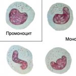 Special qualities of monocytes
