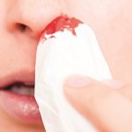 Acute leukemia (leukemia)