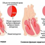 Patient with low left ventricular ejection fraction
