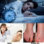 Pathologies of heart disease