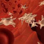 Excess platelets in the blood