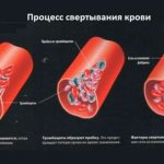 Плазменные и клеточные факторы, участвующие в процессе свертывания крови