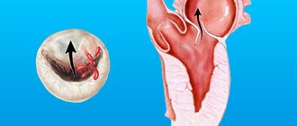 Why does reverse blood flow into the MV occur?