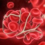 Selection and correction of anticoagulant therapy