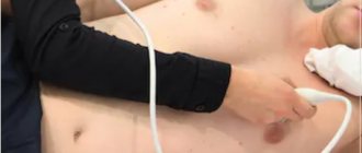 patient position during cardiac ultrasound