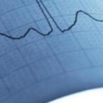 The concept of extrasystole