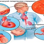 Последствия диастолического давления