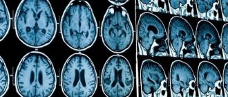 Increased VChP cannot be determined by external signs