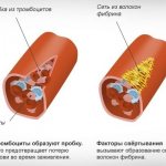 Повышенные тромбоциты в крови у женщин. Причины и лечение, что это значит