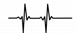 Increased heart rate with normal blood pressure