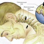 Причины и последствия