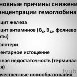 Reasons for low performance