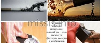 Причины предынфарктного состояния