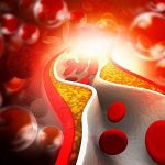 Reasons for the development of lipid metabolism disorders