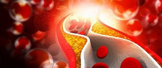 Reasons for the development of lipid metabolism disorders