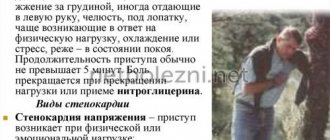 Признаки и виды стенокардии