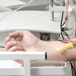 The procedure process - Alkoklinik