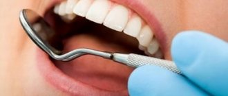 Preventing wisdom tooth bleeding
