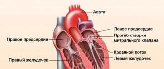 Mitral valve prolapse