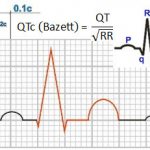 Calculation of corrected QT – Bazett&#39;s formula – QTc