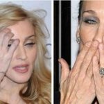 Расширенные вены на руках у известных артисток