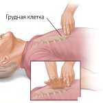 Resuscitation, closed cardiac massage