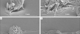Rice. 5. Scanning electron micrographs of the process of spreading an activated platelet over the surface (“Priroda” No. 2, 2014)